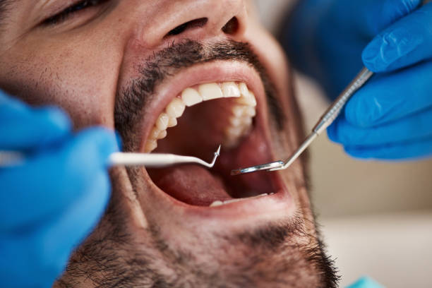 Best Pediatric Emergency Dentist in Jonesville, NC