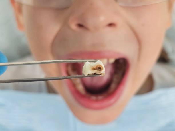 Best Cosmetic Emergency Dentistry in Jonesville, NC